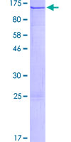 ab164114 on a 12.5% SDS-PAGE stained with Coomassie Blue.