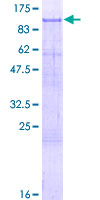 ab159845 on a 12.5% SDS-PAGE stained with Coomassie Blue.