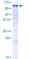 ab164667 on a 12.5% SDS-PAGE stained with Coomassie Blue.