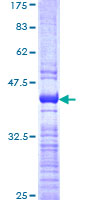 ab164668 on a 12.5% SDS-PAGE stained with Coomassie Blue.