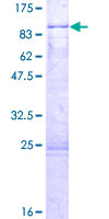 ab165978 on a 12.5% SDS-PAGE stained with Coomassie Blue.