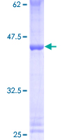 ab164384 on a 12.5% SDS-PAGE stained with Coomassie Blue.