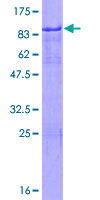 ab161430 on a 12.5% SDS-PAGE stained with Coomassie Blue.