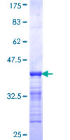 ab161431 on a 12.5% SDS-PAGE stained with Coomassie Blue.