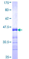 ab162092 on a 12.5% SDS-PAGE stained with Coomassie Blue.