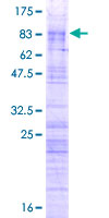 ab159975 on a 12.5% SDS-PAGE stained with Coomassie Blue.