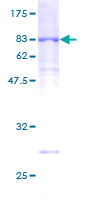 ab165994 on a 12.5% SDS-PAGE stained with Coomassie Blue.