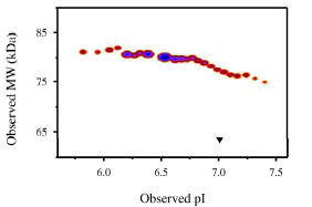 Densitometry of protein isoforms visualised by 2-DE. Spot trains are normal in human proteins and highlight the presence of multiple isoforms which differ according to their level of post-translational modification. The triangle indicates the theoretical MW and pI of the protein.
