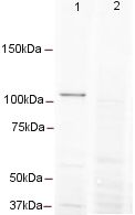All lanes : Anti-Dnmt3b antibody ( ab16049 ) at 1 µg/ml Lane 1 : CHO cell lysate Lane 2 : CHO cell lysate with Mouse Dnmt3b peptide (ab16376) at 1 µg/ml Lysates/proteins at 20 µg per lane. Secondary Goat anti-rabbit Alexa fluor 680 at 1/5000 dilution Performed under reducing conditions. Predicted band size : 100 kDa