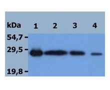 WB analysis of ab56522: 12% separating gel, 6% stacking gel; reducing conditions. Immunostaining with NTAL specific antibody. Detection with Goat anti-mouse/ HRP secondary antibody. Lane 1 to 4: Amount of mouse NTAL recombinant protein loaded on each lane: (1) 0.050 µg, (2) 0.020 µg, (3) 0.005 µg, (4) 0.001 µg.