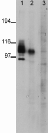 Lane 1 : Anti-PSD95 antibody [6G6-1C9] ( ab2723 ) at 0.0825 µg/ml Lanes 2 - 3 : Anti-PSD95 (phospho T19) antibody ( ab16496 ) at 1 µg/ml Lane 1 : mouse forebrain Lane 2 : mouse forebrain Lane 3 : mouse forebrain with Mouse PSD95 (phospho T19) peptide (ab17167) at 1 µg/ml Lysates/proteins at 20 µg per lane. Predicted band size : 100 kDa Observed band size : 105 kDa ( why is the actual band size different from the predicted? ) Chris Anderson, Wellcome Trust Sanger Institute, United Kingdom