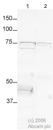 All lanes : Anti-Doublecortin antibody - Neuronal Marker ( ab28941 ) at 1 µg/ml Lane 1 : Mouse brain lysate Lane 2 : Mouse brain lysate with Rat Doublecortin peptide (ab19803) at 1 µg/ml Lysates/proteins at 20 µg per lane. Secondary Alexa fluor goat polyclonal to IgG (700) at 1/10000 dilution Performed under reducing conditions. Predicted band size : 43-53 kDa