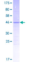 ab166490 on a 12.5% SDS-PAGE stained with Coomassie Blue.