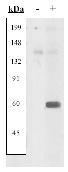 Western Blot: Extracts prepared from CEF cells not transfected (-) or transfected (+) with wild-type Src were resolved by SDS-PAGE on a 10% Tris-glycine gel and transferred to nitrocellulose. Membranes were blocked with a 5% BSA-TBST buffer overnight at 4°C, then were incubated with 1.0 µ g/mL anti-Src pan antibody. After washing, membranes were incubated with goat F(ab')2 anti-rabbit IgG alkaline phosphatase and the signal was detected using the Tropix WesternStar method.