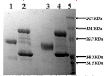 10% SDS-PAGE Lane 1: TPA Tissue Plasminogen Activator (3ug) Reduced Lane 2: TPA Tissue Plasminogen Activator (3ug) + PAI-1 Reduced (10ug) Lane 3: TPA Tissue Plasminogen Activator (3ug) Non-reduced Lane 4: TPA Tissue Plasminogen Activator (3ug) + PAI-1 Non-reduced (10ug) Lane 5: Prestained Standard