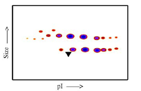 Densitometry of protein isoforms visualised by 2-DE. The densitometry scan demonstrates the purified human cell expressed protein exists in multiple isoforms, which differ according to their level of post-translational modification. The triangle indicates the theoretical MWt and pI of the protein.