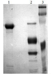 SDS-PAGE analysis of ab170080. Lane 1: 5µg Non-reduced Lane 2: 5µg Reduced Lane 3: Molecular weight markers