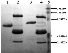 10% SDS-PAGE showing ab92728 Lane 1 ab92728 Non-reduced (3µg) Lane 2 ab92728 (3µg) + PAI-1 (12µg) Non-reduced Lane 3 ab92728 Reduced (3µg) Lane 4 ab92728 (3µg) + PAI-1 (12µg) Reduced Lane 5 MWM