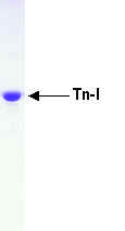 Cardiac Troponin I full length protein (ab9936) at 2.7 µg (Coomassie blue staining of SDS gel) Performed under reducing conditions. Observed band size : 24 kDa ( why is the actual band size different from the predicted? ) Additional bands at : 48 kDa (possible dimer).