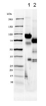 1D SDS-PAGE of ab83824 before and after treatment with glycosidases to remove oligosaccharides. Lane 1: ab83824 Lane 2: ab83824 treated with PNGase F to remove potential N-linked glycans 10 μg protein loaded per lane; Deep Purple™ stained. Drop in MW after treatment with PNGase F indicates presence of N-linked glycans.