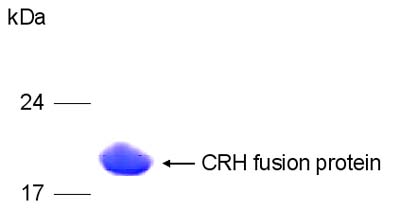 ab96279 on 15% SDS PAGE gel, Coomassie blue staining