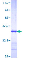 ab158986 on a 12.5% SDS-PAGE stained with Coomassie Blue.