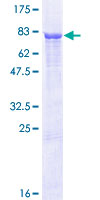 ab159270 on a 12.5% SDS-PAGE stained with Coomassie Blue.