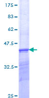 ab159271 on a 12.5% SDS-PAGE stained with Coomassie Blue.