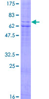 ab165776 on a 12.5% SDS-PAGE stained with Coomassie Blue.