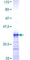 ab158711 on a 12.5% SDS-PAGE stained with Coomassie Blue.