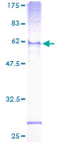 ab158713 on a 12.5% SDS-PAGE stained with Coomassie Blue.