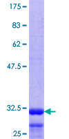 ab158714 on a 12.5% SDS-PAGE stained with Coomassie Blue.