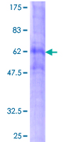 ab158717 on a 12.5% SDS-PAGE stained with Coomassie Blue.