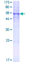 ab114804 on 12.5% SDS-PAGE Stained with Coomassie Blue.
