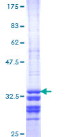 ab158718 on a 12.5% SDS-PAGE stained with Coomassie Blue.