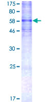 ab112303 analysed on a 12.5% SDS-PAGE gel stained with Coomassie Blue.