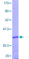 ab158719 on a 12.5% SDS-PAGE stained with Coomassie Blue.