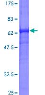 12.5% SDS-PAGE image showing ab114294 at approx 58.56kDa. Stained with Coomassie Blue.