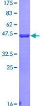 ab112316 on a 12.5% SDS-PAGE Stained with Coomassie Blue