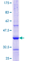 ab157821 on a 12.5% SDS-PAGE stained with Coomassie Blue.