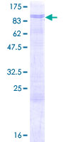 ab162011 on a 12.5% SDS-PAGE stained with Coomassie Blue.