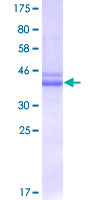ab162012 on a 12.5% SDS-PAGE stained with Coomassie Blue.