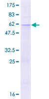 ab160956 on a 12.5% SDS-PAGE stained with Coomassie Blue.