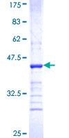 ab161653 on a 12.5% SDS-PAGE stained with Coomassie Blue.