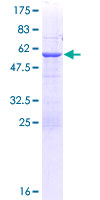ab153564 on a 12.5% SDS-PAGE stained with Coomassie Blue.