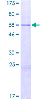 ab164394 on a 12.5% SDS-PAGE stained with Coomassie Blue.