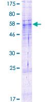 ab164706 on a 12.5% SDS-PAGE stained with Coomassie Blue.