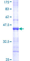 ab153329 on a 12.5% SDS-PAGE stained with Coomassie Blue.
