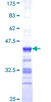 ab158817 on a 12.5% SDS-PAGE stained with Coomassie Blue.