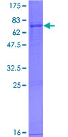 ab161001 on a 12.5% SDS-PAGE stained with Coomassie Blue.